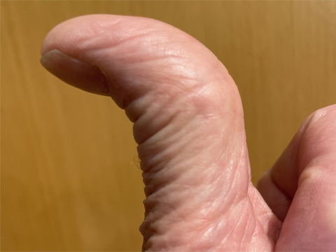 Tummen - en betraktelse